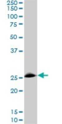 Western Blot: RNF141 Antibody (6D9) [H00050862-M01]