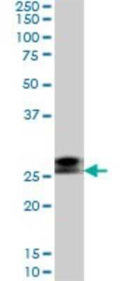 Western Blot: RNF141 Antibody (6D9) [H00050862-M01]