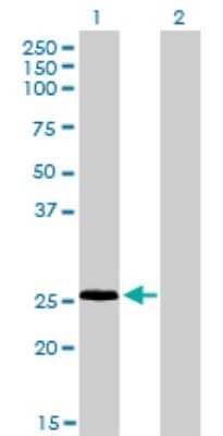 Western Blot: RNF141 Antibody (6D9) [H00050862-M01]