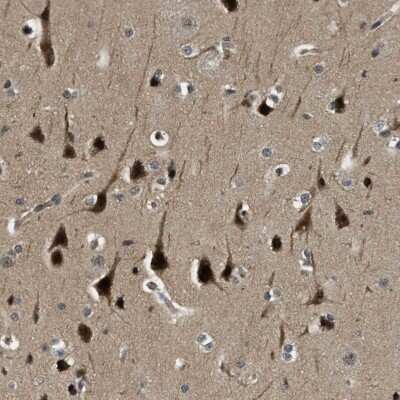 Immunohistochemistry-Paraffin: RNF141 Antibody [NBP1-80603]