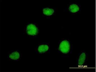 Immunocytochemistry/ Immunofluorescence: RNF144A Antibody [H00009781-B02P]