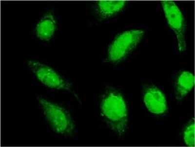 Immunocytochemistry/ Immunofluorescence: RNF165-IT1 Antibody (3A1) [H00147341-M01]