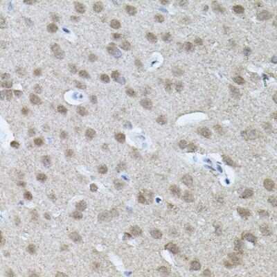 Immunohistochemistry-Paraffin: RNF166 Antibody - BSA Free [NBP2-94903]