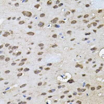 Immunohistochemistry-Paraffin: RNF166 Antibody - BSA Free [NBP2-94903]