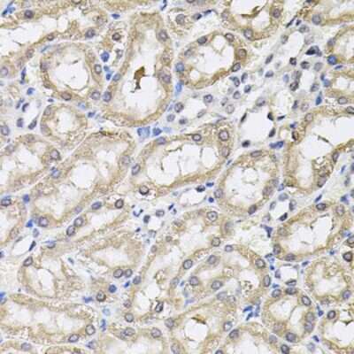 Immunohistochemistry-Paraffin: RNF166 Antibody - BSA Free [NBP2-94903]
