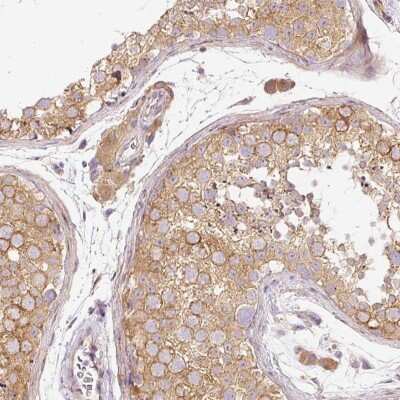 Immunohistochemistry-Paraffin: RNF167 Antibody [NBP2-30454]