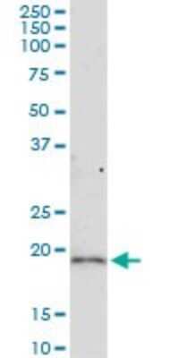 Immunoprecipitation: RNF181 Antibody (5A7) [H00051255-M01]