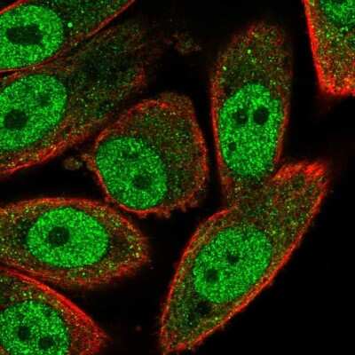 Immunocytochemistry/ Immunofluorescence: RNF181 Antibody [NBP2-13240]