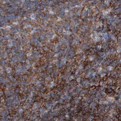 Immunohistochemistry-Paraffin: RNF182 Antibody [NBP1-82707]