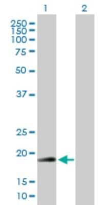 Western Blot: RNF185 Antibody [H00091445-B01P]