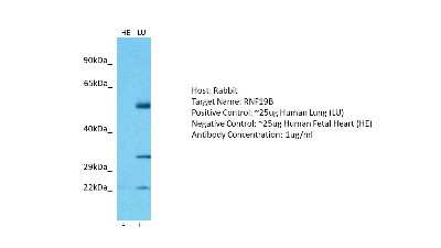 Western Blot: RNF19B Antibody [NBP2-83457]