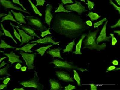 Immunocytochemistry/ Immunofluorescence: RNF2 Antibody (2B6) [H00006045-M05]
