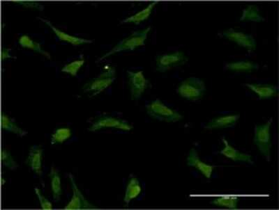 Immunocytochemistry/ Immunofluorescence: RNF2 Antibody (3G6) [H00006045-M03]