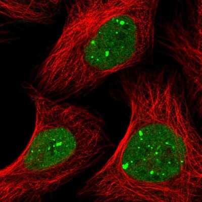 Immunocytochemistry/ Immunofluorescence: RNF2 Antibody [NBP1-88712]
