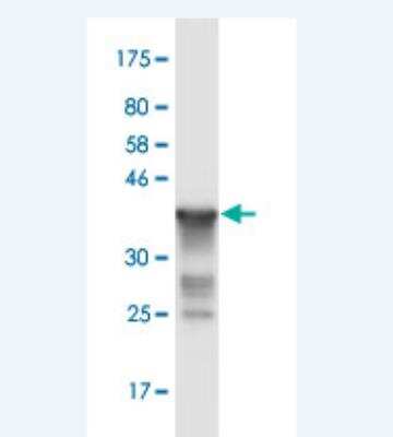 Western Blot: RNF20 Antibody (1E4) [H00056254-M02]