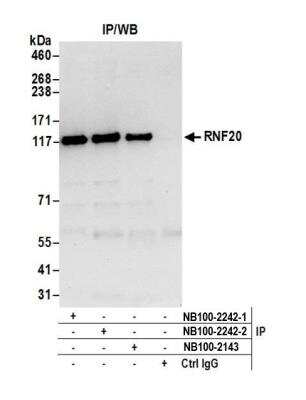 Immunoprecipitation: RNF20 Antibody [NB100-2242]