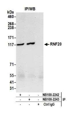 Immunoprecipitation: RNF20 Antibody [NB100-2243]