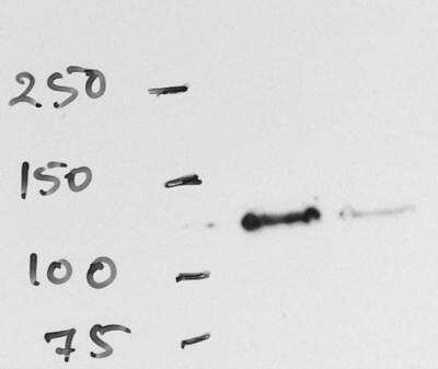 Western Blot: RNF20 Antibody [NB100-2242]