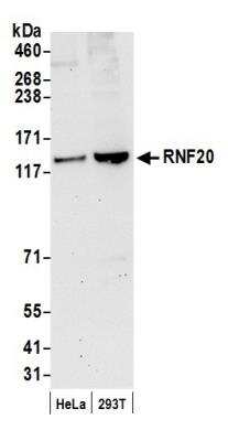 Western Blot: RNF20 Antibody [NB100-2243]