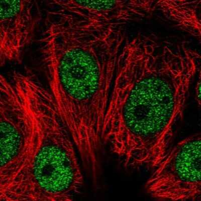 Immunocytochemistry/ Immunofluorescence: RNF208 Antibody [NBP1-90501]