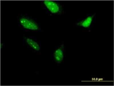 Immunocytochemistry/ Immunofluorescence: RNF212 Antibody (5H3) [H00285498-M01]