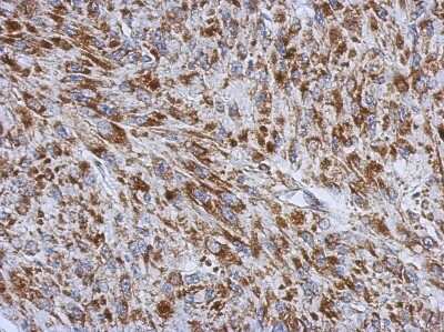 Immunohistochemistry-Paraffin: RNF212 Antibody [NBP2-20182]