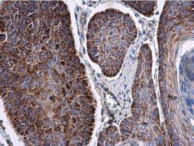 Immunohistochemistry-Paraffin: RNF212 Antibody [NBP2-20182]