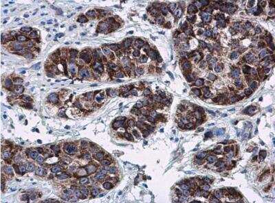 Immunohistochemistry-Paraffin: RNF212 Antibody [NBP2-20182]