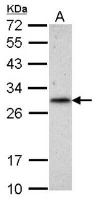 Western Blot: RNF212 Antibody [NBP2-20182]
