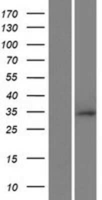 Western Blot: RNF212 Overexpression Lysate [NBP2-09530]