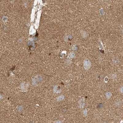 Immunohistochemistry-Paraffin: RNF219 Antibody [NBP1-88401]