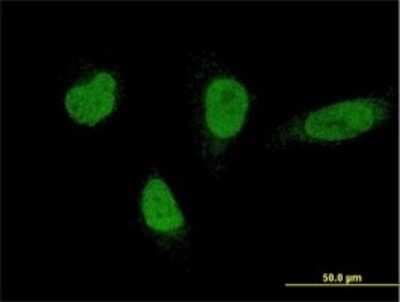 Immunocytochemistry/ Immunofluorescence: RNF220 Antibody (5E5) [H00055182-M01]