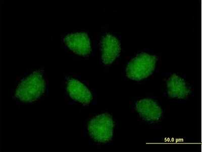 Immunocytochemistry/ Immunofluorescence: RNF220 Antibody [H00055182-B01P]