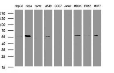 Western Blot: RNF23 Antibody (OTI2A6) [NBP2-46014]