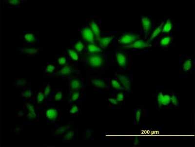Immunocytochemistry/ Immunofluorescence: RNF23 Antibody [H00056658-B02P]