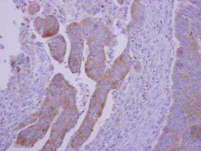 Immunohistochemistry-Paraffin: RNF23 Antibody [NBP2-20183]