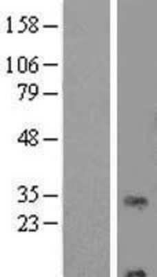 Western Blot: RNF24 Overexpression Lysate [NBL1-15447]