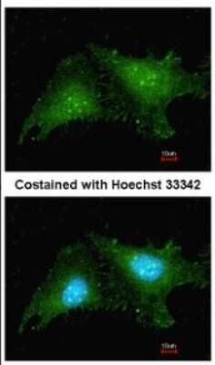 Immunocytochemistry/ Immunofluorescence: RNF25 Antibody [NBP1-31491]