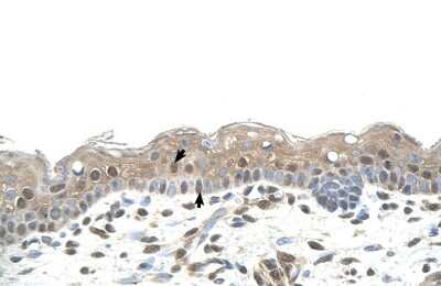 Immunohistochemistry-Paraffin: RNF25 Antibody [NBP1-55063]