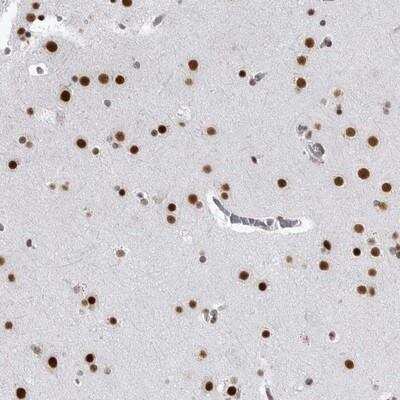 Immunohistochemistry-Paraffin: RNF26 Antibody [NBP1-81150]