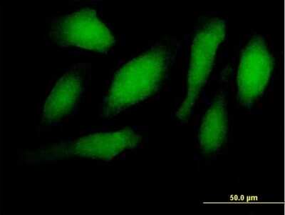 Immunocytochemistry/ Immunofluorescence: RNF34 Antibody [H00080196-B01P]