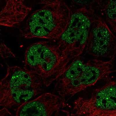 Immunocytochemistry/ Immunofluorescence: RNF34 Antibody [NBP2-56413]