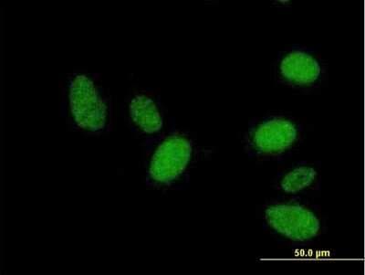 Immunocytochemistry/ Immunofluorescence: RNF36 Antibody [H00140691-B01P]