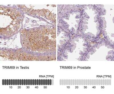 Immunohistochemistry-Paraffin: RNF36 Antibody [NBP2-42073]