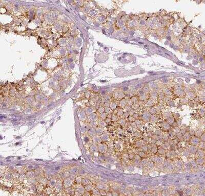 Immunohistochemistry-Paraffin: RNF36 Antibody [NBP2-42073]