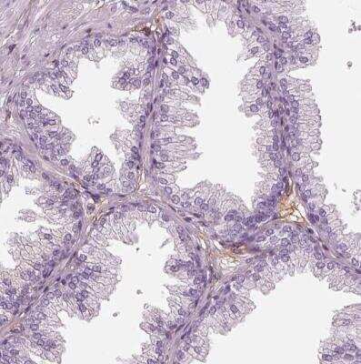 Immunohistochemistry-Paraffin: RNF36 Antibody [NBP2-42073]