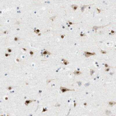 Immunohistochemistry-Paraffin: RNF38 Antibody [NBP1-86453]
