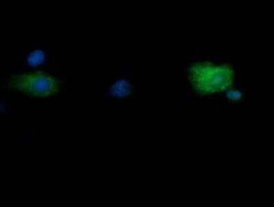 Immunocytochemistry/ Immunofluorescence: RNF39 Antibody (OTI5E10) - Azide and BSA Free [NBP2-73927]