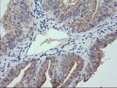 Immunohistochemistry: RNF39 Antibody (OTI5E10) - Azide and BSA Free [NBP2-73927]