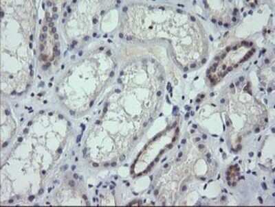 Immunohistochemistry: RNF39 Antibody (OTI5E10) - Azide and BSA Free [NBP2-73927]
